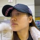 생생한의원 | 압구정한의원에서 스트레스받던 모공치료 후기