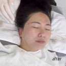 플래닝 짐(Planning Gym) | 광주 도연아카데미 크라이오 더마 플래닝 후기｜변화 확실했던 피부결 관리