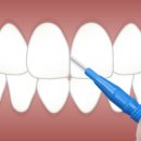 스마트하루치과의원 이미지