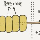 수FLEX