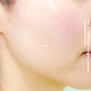 제주에스테틱 제주도 오라동 해드린스킨케어 마리꼬 리프팅 관리 후기
