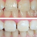 연플란트치과의원 이미지