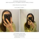송도 피부과 나다움의원 타이탄+핑크필+보톡스 리뷰 ♥