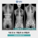 더힘의원 네이버블로그