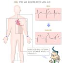 [간편]허혈성심장질환 진단비(1년50%) 특별약관 이미지