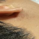 부산의 체온(미디어 | 맨발걷기 어싱 효과? 1년 맹신하다가 피부병으로 멈춘 솔직 후기