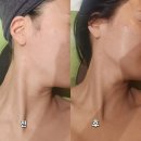 인루나 에스테틱 | 대원동 피부관리, 인루나에스테틱에서 빠르게 어려지기