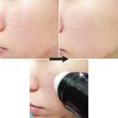 [퓨어리퍼블릭] 비비스틱(이온스톤) / 비비볼 / 이온스톤 마사지 볼