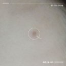 로담한의원가산 티스토리