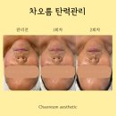 유곡 경로당 | [ 언양 피부관리 ] 차오름 에스테틱 피부관리 후기