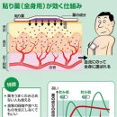 붙이는 약의 종류증가…다루기 쉽고 효력안정 이미지