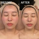 6860 | 동래피부관리 로아에스테틱 : 1:1 맞춤 케어로 속건조 싹 잡고 온 관리 받은 후기