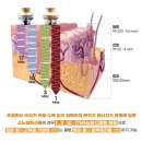 탱글탱글 LDM 물방울 리프팅 체험 이벤트 이미지