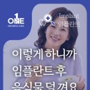 원치과기공소 | 임플란트하고 나서 음식물이 너무 많이 낀다는 후기가 많은데 왜 그런가요?