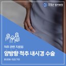 송파 척추센터의 양방향 척추내시경수술이란? 이미지