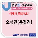 삼성유신경외과의원 | ❄️ 오십견(동결견) Q&amp;A – 삼성유신경외과와 함께 알아보는 어깨 통증