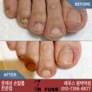 레푸스 평택점 네이버블로그