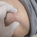 이종구한의원 이미지