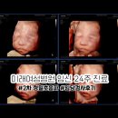 [임신 중기] 24주 부산 미래여성병원 임당검사 & 2차 정밀초음파 후기