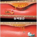 당뇨에 좋은 차 변비에 좋은 차 뽕잎차 효능 이미지