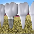 서울나란이치과의원 이미지
