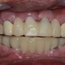 가까운치과기공소 이미지