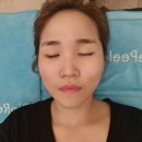 로하나 | 강남피부관리 로하나코스킨 탄력케어, 건식마스크 후기