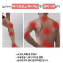 음 이 온 패 치 (원적외선방사) 이미지