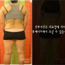안양한의원 다이어트 후기!