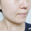 힐링블링