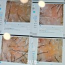 부산두피관리샵으로 탈모케어존 부산동래점에서의 관리 후기!