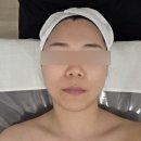 힐링탑 피부관리실