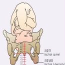 내가 기억하려고 쓰는!!! 린 여성병원 출산 후기 (유영 원장님, 유도분만, 38주 1일차 분만)