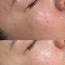 안민로-1 | 창원피부관리 ㅣ 안민동피부관리 [하엔에스테틱] RX장벽복구케어 솔직추천 후기