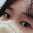 아이윌의원 | 동두천 비립종제거 피부과- 비립종제거,레이저 후기