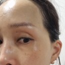 베아므