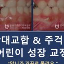 다정치과기공소 네이버블로그
