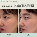 소솜에스테틱 - 전주시 덕진구 | 소솜에스테틱