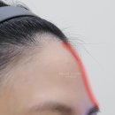 천안백석동피부과 가기 전, 자연스러운 필러를 위한 핵심 체크리스트 5가지