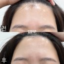 영등포구청 왁싱 추천 | 아워블루왁싱 눈썹 헤어라인 이마 페이스 후기