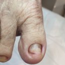 레푸스 구로점 이미지