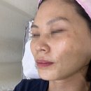 라라스킨 이미지