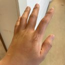 유니팜약국 | [뉴질랜드 약국] 화상입은 후기..비판텐(Bepanthen)