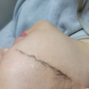 용쥬르샵 | [W.결혼준비6] 인천주안, 비립종제거로 유명한 용쥬르샵에서 스킨플래닝 후기(feat.내돈내산)