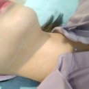 트루스컬프후기: 이중턱리프팅 트루스컬프 직접 받아봤어요