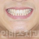 인비스치과의원 이미지