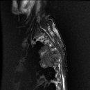 C/T-SPINE MRI 영상입니다... 이미지