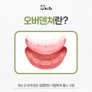 e덴쳐치과기공소 | 창원중동치과 오버덴쳐와 틀니 뭐가 다른가요?