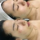 안산미백관리 및 잡티제거 잘 하는 곳 : 마음을채우다 방문 후기
