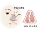 코 이미지